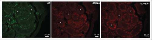 Figure 1. KIT+ spermatogonia are an heterogeneous populations of cells concerning STRA8 and SOHLH1 expression. Immunodetection in adjacent sections of KIT, STRA8 and SOHLH1 in histological sections from 7 ddp mouse testis. Asterisks indicate sections in which SOHLH1+ cells are STRA8−.