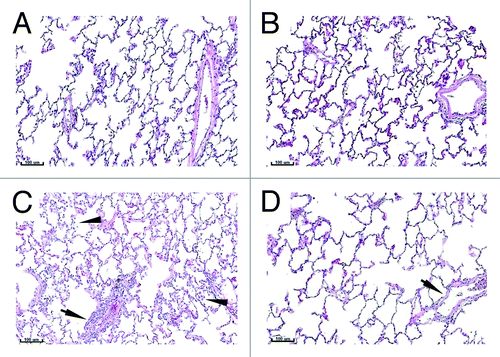 Figure 1. Lung histology. Lungs from control (A and B) or vaccinated (C and D) animals were collected on Study Day 18 (A and C) and 43 (B and D). Tissues were sectioned, H&E stained, and examined by microscopy. Arrows with stems indicate perivascular infiltrates. Arrows without stems indicate alveolar macrophages. Bars indicate 100 µm scale.
