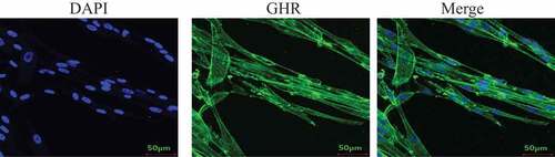 Figure 1. Analysis of GHR expression by CLSM. Bm-MSCs were seeded on the slides. When cells reached 50–60% confluence. The cells were fixed using 4% PFA for 10 min at RT. After washing, the cells were permeabilized Triton-X 100 for 15 min. The cells were then blocked with 5% BSA for 2 h at 37°C. After three washes, anti-GHR antibody was added and incubated at 37°C for 2 h.After three washes, the secondary antibody was added and incubated for 1 h at 37°C. All images were acquired with a laser scanning confocal microscope (Leica SP5).