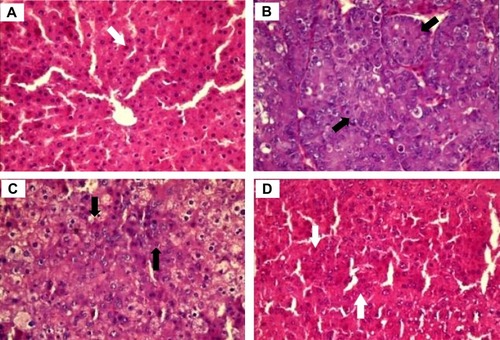 Figure 14 Sections of liver tissue obtained from untreated control (A), DENA (B), SFN (C), and CNTs-SFN-MCs-treated rats (D). The white arrows refer to normal hepatic cords, and the black arrows refer to trabeculae formation. The magnification power is x400.