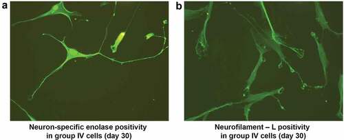 Figure 9. Immunocytochemical analysis of neuroprogenitor-like cells on d 30 after alternative treatment with bFGF and antioxidants showed NSE positivity in neuron-like cells. Cells exhibited a pyramidal neuron-like structure with a cone-shaped cell body (a). NF-L positivity in the filaments of neuron-like cells. NF-L was also present in growth cones, unlike progenitor cells; the filaments are long denoted by the white arrow (b). (Magnification20x).