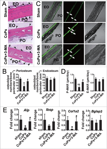 Figure 5. The autophagy inhibitor 3-MA rescued osteoblast numbers and functional disturbance induced by CoPs. (A) Representative HE staining images of calvaria from each group. Osteoblasts are indicated by black arrowheads. Scale bar: 100 µm. EO, endosteum; PO, periosteum. (B) Osteoblast numbers/bone perimeter (mm−1) of endosteum and periosteum in (A). (C) Representative images of new bone formation of calvaria sections from each group were determined by calcein double labeling. Scale bar: 100 µm. (D) P-MAR and E-MAR in (C). (E) Real-time PCR of Alp, Ibsp, Col1a2 and Bglap3 of calvarial bone extracts from each group. Values are expressed as means ± S.E.M. n = 7 mice per group. *P < 0.05, **P < 0.01 vs. sham; #P < 0.05 vs. CoPs group.