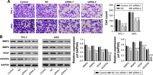 Figure 4 IL13Rα2 siRNA inhibited cell invasion in TPC-1 cells.