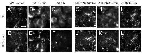 Figure 8. Analyses of lysosomal permeabilization following NPe6 PDT. Cultures of WT (A–F) and ATG7 KD (G–L) cells were preloaded with fluorescein-conjugated 10-kDa dextran polymers as described in Materials and Methods prior to being sensitized with 20 μM NPe6 and irradiated (270 mJ/cm2). LTR was added to the cultures 10 min prior to imaging. LTR (A–C and G–I) and dextran (D–F and J–L) fluorescence were captured 10 min and 4 h after irradiation. Similar results were obtained in a second study.