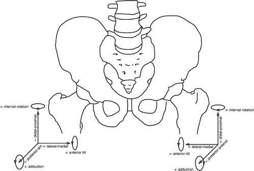 Figure 4. A schematic overview of the use of coordinate systems in defining micromotions of hip implants. Pay special attention to lateral-medial translation, internal rotation and adduction. These have to change sign in order to be able to compare these parameters for prostheses implanted at the left side and right side.