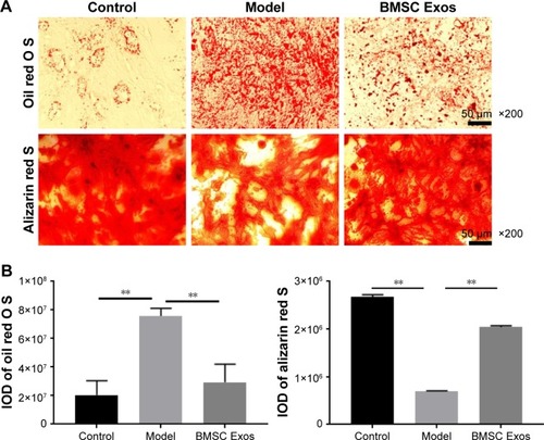 Figure 2 BMSC Exos inhibited adipogenic differentiation and enhanced osteogenic differentiation in steroid-induced BMSCs.