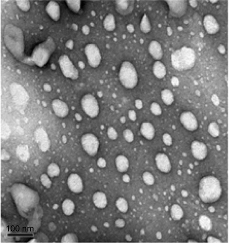 Figure 2 Transmission electron micrograph of polydatin-loaded liposome formulation. 2,500×.