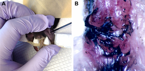 Figure S2 Validated mouse intra-articular injection.Notes: Twenty microliters of alcian blue solution was injected with an insulin syringe into the mouse knee joint cavity (A). The mouse was sacrificed after 24 hours and the knee joint cavity was opened by a scalpel. Gross observation showed that alcian blue adhered to the cartilage and synovial membrane in the joint cavity, indicating that intra-articular injection was feasible for the study (B).