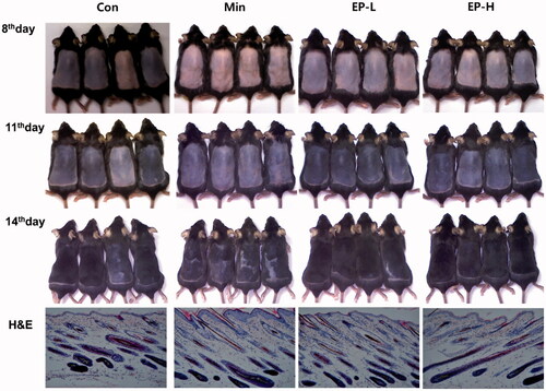 Figure 3. Gross and microscopic observation of the dorsal skin. The dorsal skin of mice in each group was photographed at 8, 11 and 14 days after treatment. Hair growth and skin darkness was more prominent in EP groups than Con and Min groups. Con: control, Min: minoxidil, EP-L: 1 mg/day of Eclipta prostrata, EP-H: 10 mg/day of Eclipta prostrata. After 14 days of treatment, skin tissues were collected, and stained with haematoxylin and eosin. Dermal papilla was enclosed in the control mice, while hair shaft was appeared through the hair canal in Min, EP treated mice. Original magnification: ×100 (H&E).