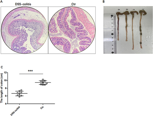 Figure 1 Evaluation of the DSS-induced colitis in mice. Two groups of mice were studied, the DSS-induced colitis group and the control healthy group. The results of representative H&E staining (A), colon length measurement (in B representative pictures from two pairs of mice), and colon length (in C from 8 pairs) are presented. Colon length values represent the mean±SD and statistically significant results are denoted as ***p <0.001.
