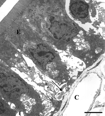 Figure 6 Electron microscopy of intestinal mucosa to assess epithelial damage. Typical electron micrograph of transverse section through intestinal villus (away from Peyer's patch) from rat that had been injected with 1 mg PS-ODN in 1 ml, followed 2 minutes later by 50 mg DBBF-Hb in 5 ml. The experiment was terminated eight minutes after the DBBF-Hb injection. Similar to the results of injection with iron dextran (Figure 5) and with DBBF-Hb alone (not shown), the epithelial cells (E), with extensive cytoplasmic protrusions, are separating from each other and from the basement membrane (arrows). Near Peyers' patches, the areas of epithelial disruption were even more extensive than with DBBF-Hb alone. C: capillary containing two red blood cells. Scale bar: 5 microns.