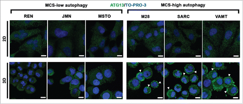 Figure 3. In mesothelioma cells, ATG13 puncta reflect the autophagic flux only in 3D. Mesothelioma cells were grown as monolayers (2D) on coverslips or as MCS (3D). Spheroid cells were trypsinized and cytospun on glass slides. Cells adherent on cover slips or glass slides were then fixed, stained for ATG13 (green) and nuclei (blue), and imaged by confocal microscopy. Representative ATG13 puncta are indicated by arrowheads. Scale bars: 10 µm.