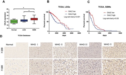 Figure 1 GALE expression in glioma is associated with tumor grade. (A) Quantitative analysis of GALE gene expression in the TCGA dataset. (B, C) The prognostic significance of GALE expression in LGG and GBM patients in the TCGA (n=667) database was analyzed. (D) IHC staining of GALE expression in gliomas of different grades and normal brain specimens. Magnification: ×200, upper; ×400, lower. *P < 0.05.