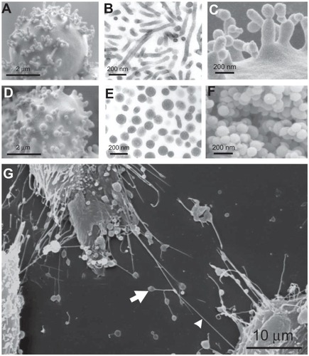 Figure 5 Nanobuds and nanovesicles of the erythrocyte membrane and nanotubules connecting T24 cancer cells. In erythrocytes, budding and vesiculation was induced by adding a detergent. The type of detergent determines the character of the nanobuds and nanovesicles. (A) Scanning electron micrograph of echinocyte budding induced by dodecylmaltoside, (B) transmission electron micrograph of isolated tubular nanovesicles induced by dodecylmaltoside, (C) scanning electron micrograph of the budding erythrocyte membrane, (D) scanning electron micrograph of echinocyte budding induced by dodecylzwittergent, (E) transmission electron micrograph of isolated spherical nanovesicles, (F) scanning electron micrograph of isolated spherical nanovesicles, (G) nanotubules with dilatations connecting urothelial cancer cells. (A, B, D, E, and G) reproduced with permission of Schara et alCitation63 and (C and F) reproduced from Sustar et al.Citation64