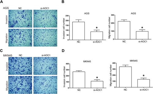 Figure 4 Knockdown of AOC1 inhibits cell invasion and migration in human gastric cancer cells. (A) and (C) Transwell assays detecting the invasion and migration of human AGS and MKN45 cells. (B) and (D) Invaded and migrated cells in si-AOC1 group or NC group were counted. All experiments were performed for three repeated times. *P<0.05.