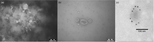 Fig. 2.  Transmission electron microscopy (TEM) images of plasma EVs (a) before and (b) after qEV purification and (c) CD9+ immunogold-labelled EVs after qEV purification.