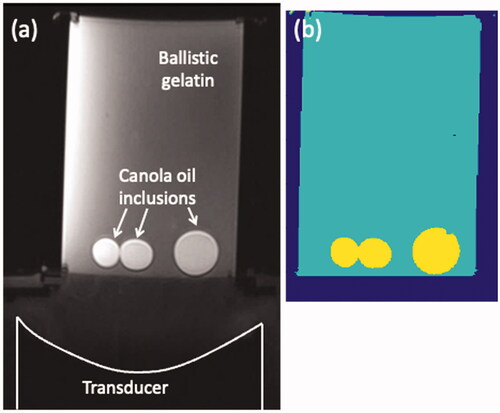 Figure 2. A representative T-Type heterogeneous phantom (102 × 150 mm) used for the MRgFUS sonication studies. (a) Axial T1w image of the phantom in the testing column with the focused ultrasound transducer, the ballistic gelatin and the canola-oil inclusions labeled. (b) Segmented computational model with three material types: water, gelatin and canola oil. Resolution of both images is 0.25 mm isotropic.