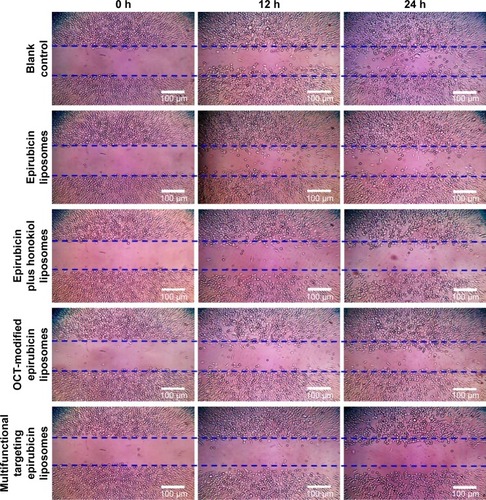 Figure 6 Blocking wound healing effects in LLT cells after treatments with the varying liposomal formulations. Magnification ×100.Abbreviations: LLT, Lewis lung tumor; OCT, octreotide.