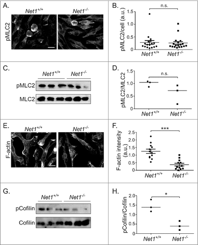 Figure 2. Net1 deletion reduces F-actin content in BMMs. (A) Representative images of pMLC2 staining of BMMs from wild type and Net1 KO mice. Scale bar is 10 µm. (B) Quantification of pMLC2 staining in multiple fields from three different BMM isolates for each genotype. (C) Western blot for pS19-MLC2 and total MLC2 in three different isolates of wild type and Net1 knockout BMMs. (D) Quantification of pS19-MLC2/MLC2 Western blots. (E) Representative images of F-actin staining in BMMs from wild type and Net1 KO mice. Scale bar is 10 µm. (F) Quantification of F-actin staining in multiple fields from three different BMM isolates for each genotype. (G) Western blot for pS3 cofilin and total cofilin in three different isolates of wild type and Net1 knockout BMMs. (H) Quantification of pS3-cofilin/cofilin Western blots. Bars are median values for all plots. n.s. = not significant. * = p < 0.05. *** = p < 0.001.