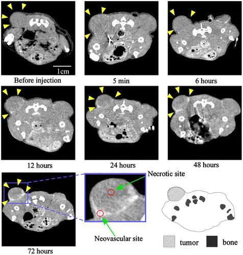 Figure 6. Contrast effect within a tumor after the injection of 30-nm Au-PEG. The tumor signal was greatly enhanced, and the tumor border was clearly imaged. Yellow arrowheads demonstrate the tumor region. The CT values of the regions of interest (ROIs), which are shown in red circles, were measured. The mean CT values of the necrotic site (tumor center) and neovascular site (tumor border) were 63 ± 12 HU and 235 ± 22. HU, respectively.