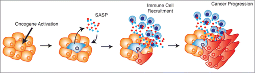 Figure 1. Senescence-associated cytokines establish an inflammatory microenvironment and promote cancer progression. Upon oncogene activation cells become senescent. The senescent cells produce and secrete the senescence-associated secretory phenotype (SASP), which reinforces senescence within the lesion and recruits immune cells to the surrounding tissue. The immune cells, along with the SASP, generate an inflammatory microenvironment, which in certain contexts fuels cancer progression.