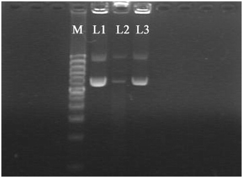 Figure 7. Agarose gel electrophoresis image of c-Myc-siRNA3-pDNAs after preparation of NPs: L1, the original c-Myc-siRNA3-pDNAs; L2, c-Myc-siRNA3-pDNAs extracted from the supernatant; L3, c-Myc-siRNA3-pDNAs extracted from the NPs; M, marker.