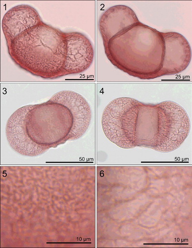 Plate 2. Photographs taken under light microscopy (LM) of treated Cedrus atlantica pollen grains stained with Safranin. Scale indicated on each image. Figures 1–2. Equatorial view showing complete grain at different foci. Figures 3–4. Polar view of complete grain. Figure 5. Close-up of corpus surface. Figure 6. Close-up of saccus surface.