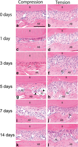 Figure 2. Microphotographs of haematoxylin-eosin-stained sections in the intact periodontal ligament (PDL) (a, b) and the PDL on days 1 (c, d), 3 (e, f), 5 (g, h), 7 (i, j), and 14 (k, l) after initiating tooth movement. After 5 days, compressed and stretched PDL fibroblasts are detectable in the compression (g) and tension (h) areas, respectively. Furthermore, some resorption lacunae (RL) are present in the compression area. After 14 days, no remarkable morphological changes to the PDL are observed. Arrowheads in g indicate large cells in the RL. R; root, AB; alveolar bone. Scale bar = 50 μm (a). All panels are at the same magnification.