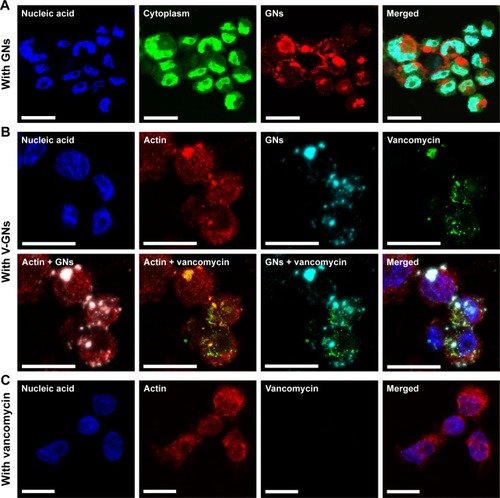 Figure 6 In vitro internalization of fluorescently labeled gelatin nanospheres (GNs, A) and GNs loaded with fluorescent-labeled vancomycin (V-GNs, B) by THP-1-derived macrophages after 24 hours of culture. Cells incubated with free vancomycin without GNs as carriers were used as controls (C). Nucleic acid of the cells was stained with DAPI/blue, and cytoplasm and actin skeleton with Cell-Tracker™ CMFDA/green (in A) and Alexa Fluor® 568 Phalloidin/red (in B and C), respectively. Cell-Tracker™ CMFDA/green also stained nucleic acid of the cells. The fluorescent-labeled GNs were displayed in red (in A) and in cyan (in B). Scale bars represent 20 μm (in A and B) and 10 μm (in C).