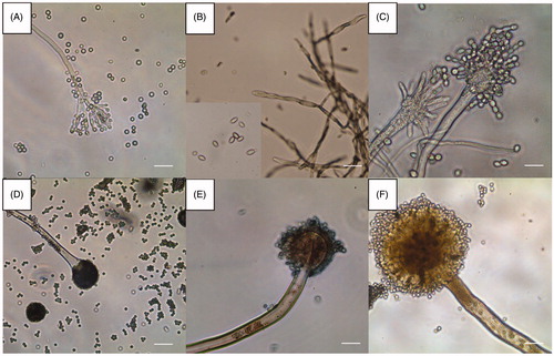 Figure 4. Optical microscopic images of the six representative isolates from this study (scale bars = 10 µm). (A) Isolate of sampling spot3, Penicillium sp1 DUCC6000; (B) Isolate of sampling spot1, Cladosporium sp.1 DUCC6005; (C) Isolate of sampling spot2, Aspergillus sp.1 DUCC6001; (D) Isolate of sampling spot4, Aspergillus sp.2. DUCC6003; (E) Isolate of sampling spot5, Aspergillus sp.3 DUCC6002; (F) isolate of sampling spot6, Aspergillus sp.4 DUCC6004.