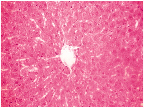 Figure 5. MERV per se group rat liver section showing normal pattern of histological architecture.
