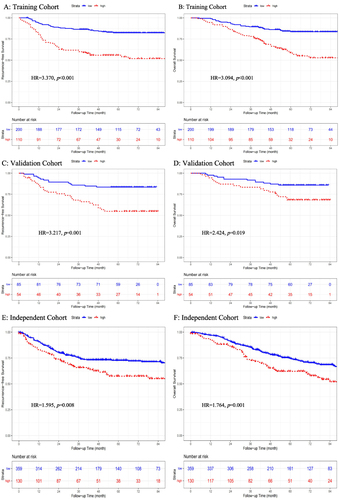 Figure 2 Kaplan‒Meier curves of recurrence-free survival and overall survival stratified by AMC density in the training (A and B), validation (C and D), and independent (E and F) cohorts.