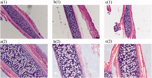 Figure 10. Haematoxylin-eosin stain (a) (1)(2) is the blank group 4 × 10 and 10 × 10, (b) (1)(2) is the model group 4 × 10 and 10 × 10, (c) (1)(2) is the therapy group 4 × 10 and 10 × 10).