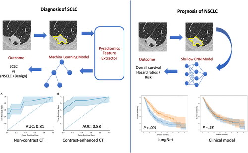 Figure 3. Graphical overview of the methods and results covered in the symposium. (left figure) Diagnosing small-cell lung cancer (SCLC) using a radiomics workflow – image features extracted from the segmented nodule using pyradiomics were used to train machine learning models for discriminating SCLC from non-small-cell lung cancer (NSCLC) and benign nodules. (right figure) Prognosticating overall survival for NSCLC – a deep learning model was developed to predict overall survival based on CT scans. CNN: convolutional neural network; CT: computed tomography.