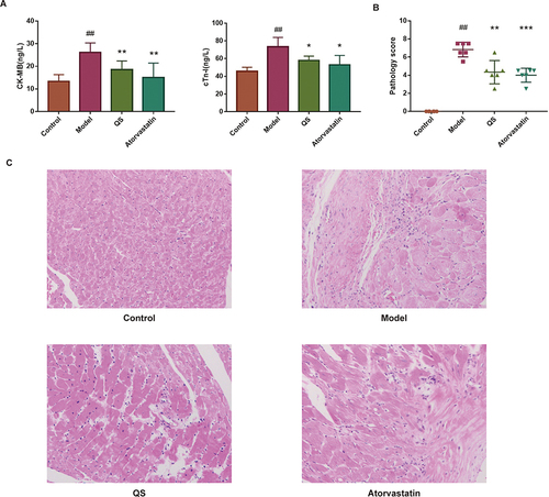 Figure 3 Effect of Qianshan Huoxue Gao (QS) on the heart of acute coronary syndrome (ACS) model rats. (A) Detection of cardiac enzymes in different groups. (B) Pathological score of the heart tissue. (C) Hematoxylin and eosin (HE) staining of the heart tissue. ##P<0.01 compared with the control group; *P< 0.05, **P<0.01, ***P<0.001 compared with the model group.