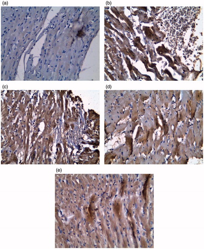 Figure 6. Caspase-3 DAPI staining for apoptotic cells in heart tissues. (a) Section from Control rat showing positive staining for caspase 3. (b) ISO only rat tissue showing focal deeply-stained muscle fibers (heavily positive) for caspase 3; extravasated blood appears at periphery of section. (c) BM-MNC-treated; (d) PRAV-treated; and (e) PRAV + BM-MNC-treated rat tissue.