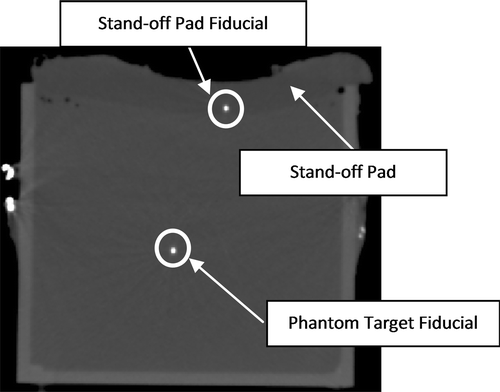 Figure 7. Sample CT image showing one phantom fiducial and one stand-off pad fiducial. The curved appearance of the stand-off pad is due to the coupling gel between the pad and phantom.
