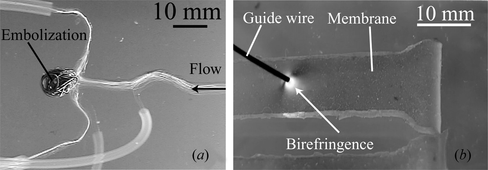Figure 1 (a) Embolization simulation in silicone model of cerebral aneurysm. (b) Birefringence produced by stress on photoelastic membrane with a 0.8 mm diameter guide wire. The guide wire is applying a force of 0.3 N to the membrane.