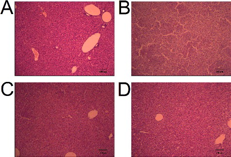 Figure 2. Liver histological analysis of cisplatin-treated mice with or without administration of baicalein: control group (A), cisplatin only group (B), cisplatin + baicalein (60 mg/kg) group (C) and baicalein (60 mg/kg) only group (D).