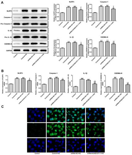 Figure 4 KCNQ1OT1 interference decreased the pyroptosis of HG-induced HK-2 cells. (A) The protein expression of NLRP3, cleaved-caspase1, IL-1β and GSDMD-N was decreased in HG-induced HK-2 cells and increased in HG-induced HK-2 cells transfected with shRNA-KCNQ1OT1-1. *P<0.05, **P<0.01 and ***P<0.001 vs. control group. #P<0.05 and ##P<0.01 vs. control+HG group. ∆P<0.05 and ∆∆P<0.01 vs. shRNA-NC+HG group. (B) The mRNA expression of NLRP3, cleaved-caspase-1, IL-1β and GSDMD-N was decreased in HG-induced HK-2 cells and increased in HG-induced HK-2 cells transfected with shRNA-KCNQ1OT1-1. **P<0.01 and ***P<0.001 vs. control group. #P<0.05, ##P<0.01 and ###P<0.001 vs. control+HG group. ∆P<0.05 and ∆∆P<0.01 vs. shRNA-NC+HG group. (C) GSDMD-N expression was verified by the images of immunofluorescence. (n=3).