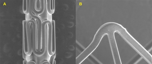 Figure 2 Scanning electron microscopy: (A) crimped Tetriflex SES; (B) expanded Tetriflex SES.