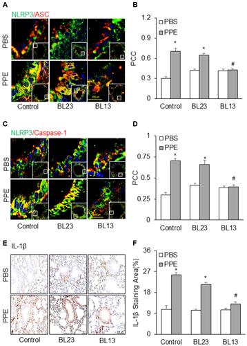 Figure 7 Effects of electroacupuncture at the acupoint Feishu (BL13) and Shenshu (BL23) on NLRP3 inflammasome formation and activation induced by PPE instillation. Representative images depict NLPR3 colocalization with (A) ASC or (C) caspase-1. (B and D) Summarized data in the bar graph shows PCC. (E) Representative images depicts IL-1β immunostaining in the lung. (F) Summarized data shows IL-1β levels in different treatment groups. (n=6). *P<0.05 vs PBS treatment. #P<0.05 vs PPE treatment group without EA or mice receiving EA at lung-nonspecific acupoint, BL23.