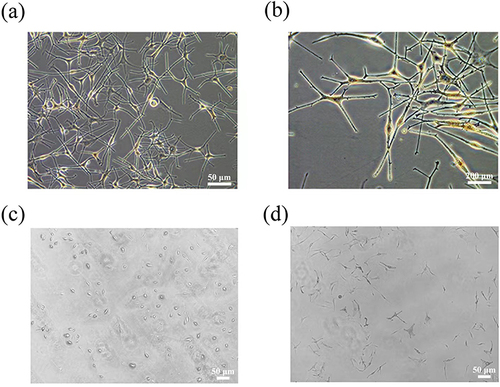 Figure 1 (a and b) Melanocytes were isolated from human foreskin. (c) The melanocytes were observed before staining with L-DOPA. (d) The melanocytes were stained with L-DOPA.