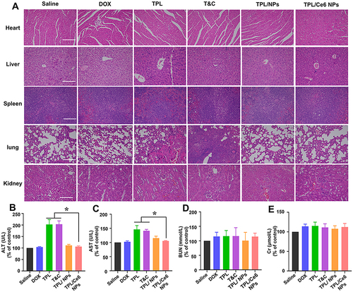 Figure 6 Histological analyses of main organs and blood biochemical indexes derived from H22-bearing tumor mice. (A) H&E histological analyses of main organs after various treatments of the H22 tumor model. The content of ALT (B), AST (C), BUN (D), and Cr (E) in blood after treatment. The scale bar is 50 μm. *p < 0.05 indicates a statistically significant difference between groups.