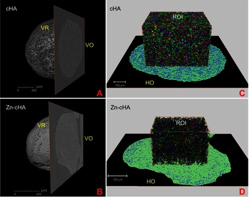 Figure 2 SR-µCT of cHA and Zn-cHA microspheres before implantation. (A,B) VR of both cHA and Zn-cHA microspheres with a VO from reconstruction. (C,D) ROI box of cHA and Zn-cHA microspheres showing individual pores distribution volume (each color represent the individual pores quantized); and HO of the segmented phases (black: background; green: biomaterial; blue: all pore space).Abbreviations: SR-µCT, Synchrotron radiation-based X-ray microtomography; cHA, carbonated hydroxyapatite; Zn-cHA, Zinc-doped carbonated hydroxyapatite; VR, volume rendering; VO, vertical orthoslice; HO, horizontal orthoslice; ROI, region of interest.