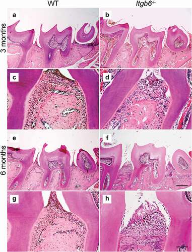 Figure 2. The histological view of periodontal tissues in 3- and 6-month-old Itgb6−/− and WT mice.