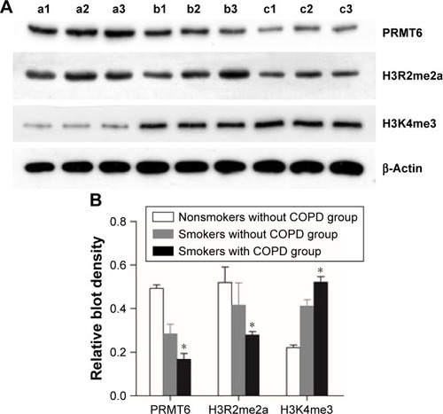 Figure 1 Expression of protein in the lung tissue of patients.