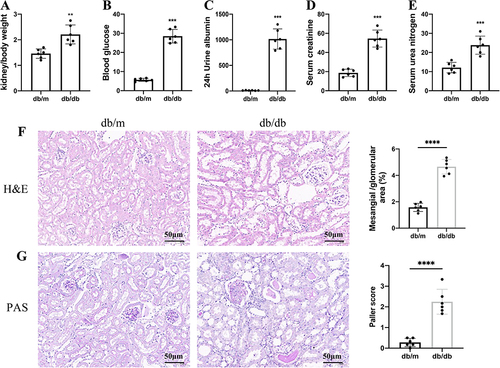 Figure 11 Basic information of mouse model. (A) Kidney weight/body weight ratio. (B) Blood glucose level. (C) 24 h urine albumin excretion levels. (D) Serum creatinine level. (E) Serum urea nitrogen. (F) H&E staining of the mouse kidneys. (G) PAS staining of mouse kidneys. The results are expressed as the mean ± SD. **P < 0.01, ***P < 0.001, ****P < 0.0001 vs db/m. All figures scale bar = 50 μm.