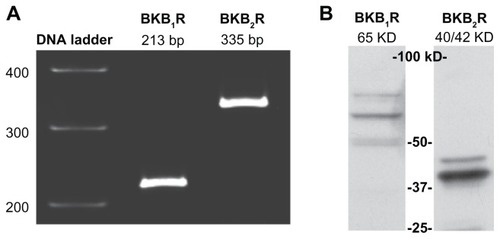 Figure 1 A498 cells express BK B1 and BK B2 receptors.Notes: (A) RT-PCR demonstrates the presence of BK B1 and BK B2 mRNA receptors in A498 cells. (B) Western blot analyses of A498 cell lysates (40 μg of total protein) with BK B1 and BK B2 receptor antibodies supporting the expression of BK receptors on a protein level. Antibodies were used at a 1:1000 dilution as per the manufacturer’s recommendations.Abbreviations: BK, bradykinin; RT-PCR, reverse transcription-polymerase chain reaction.