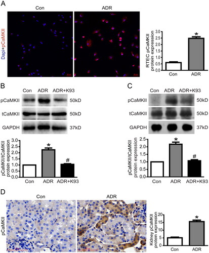 Figure 1. CaMKII activity was increased in ADR-injured RTECs. (A) Representative micrographs of dual-color fluorescence staining for pCaMKII (red) and DAPI (blue) from Con and ADR culture RTECs. Magnification ×200, scale bar = 50 μm. (B) Western blotting showed that the CaMKII activity (the protein expression of pCaMKII/tCaMKII) increased in ADR-injured culture RTECs, and this was prevented by using K93 (CaMKII activity inhibitor; p < 0.01). (C) CaMKII activity increased in kidney tissue cells of ADR-treated mice, and this was prevented by using K93 (p < 0.01). (D) Representative micrographs of immunohistochemical staining for pCaMKII (brown) in kidney sections. Magnification ×400, scale bar = 50 μm. Mean ± SE, n = 6. *p < 0.01 vs. Con. #p < 0.01 vs. ADR. There was no statistically significant difference between the Con and ADR + K93 groups.